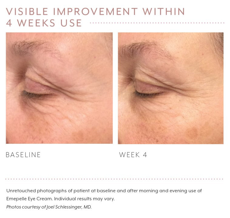 Emepelle Eye Cream – 15mL