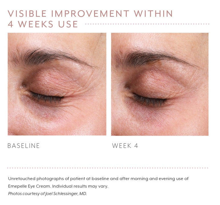 Emepelle Eye Cream – 15mL