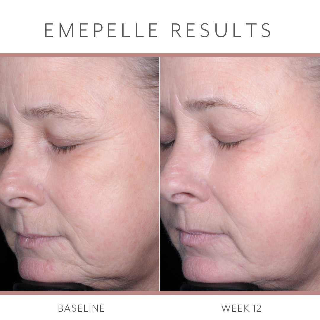 Emepelle Night Cream – 48g